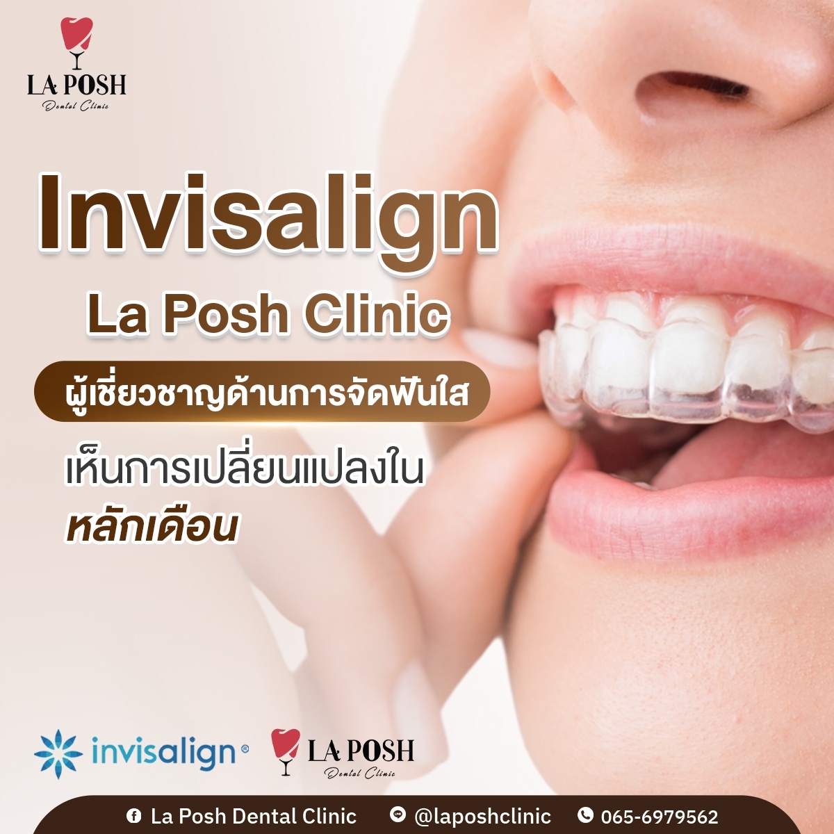 LINE_ALBUM_ภาพกราฟฟิกXP2-2_240721_22