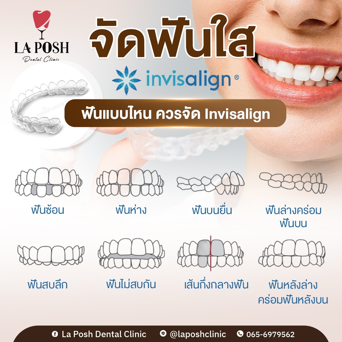 LINE_ALBUM_ภาพกราฟฟิกXP2-2_240721_25