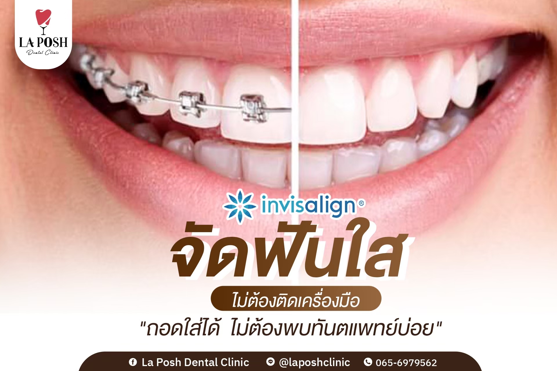 LINE_ALBUM_ภาพกราฟิก 25 ภาพ_240721_14