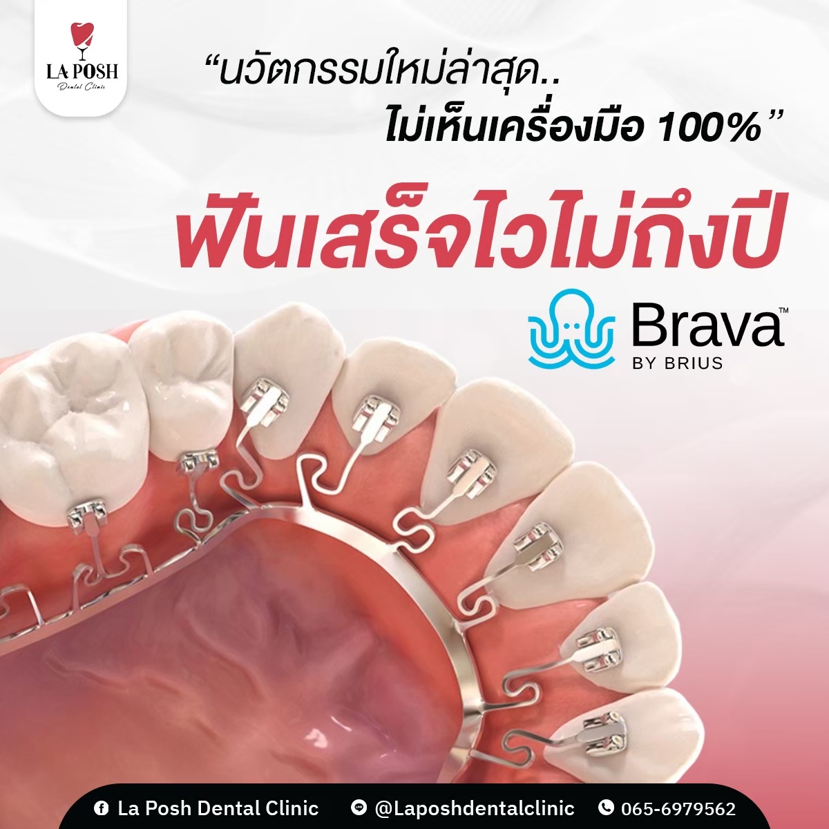 LINE_ALBUM_ภาพกราฟิก 25 ภาพ_240721_5