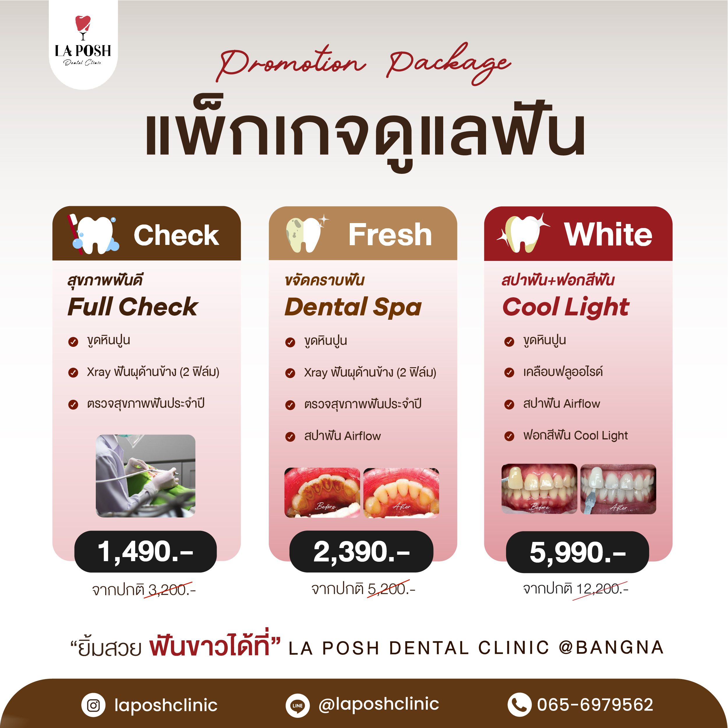 Package ดูแลฟัน-01